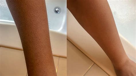 arm hair|Shaving Arms: Pros & Cons, Side Effects, and How to Do It Properly